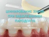 Шинирование зубов при заболеваниях пародонта