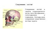 Соединение костей. Соединение костей в скелете подразделяется на три типа: неподвижное, полуподвижное и подвижное. Неподвижное соединение представлено костями черепа.