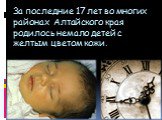 За последние 17 лет во многих районах Алтайского края родилось немало детей с желтым цветом кожи.