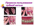 Правила пользования зубной нитью