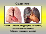 Слева – лёгкие некурящего человека, справа – курильщика (чёрная, гниющая масса).