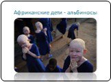 Африканские дети - альбиносы