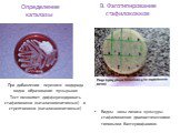 Определение каталазы. При добавлении перекиси водорода видно образование пузырьков Тест позволяет дифференцировать стафилококки (каталазопозитивные) и стрептококки (каталазонегативные). В. Фаготипирование стафилококков. Видны зоны лизиса культуры стафилококков диагностическими типовыми бактериофагам