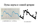 Пульс аорты и сонной артерии. СОВРЕМЕНАЯ ЗАПИСЬ. ПО ФРАНКУ