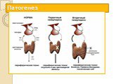 Патология эндокринной системы Слайд: 27