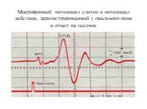 Микрофонный потенциал улитки и потенциал действия, зарегистрированный у овального окна в ответ на щелчок