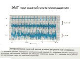 ЭМГ при разной силе сокращения