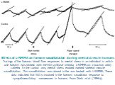 Effects of L-NMMA on forearm vasodilatation during mental stress in humans Tracings of the forearm blood flow responses to mental stress in an individual in which one forearm was treated with the NO synthase inhibitor L-NMMA via a brachial artery catheter. In the control arm, mental stress evoked ma