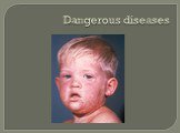 Dangerous diseases