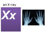 an X-ray