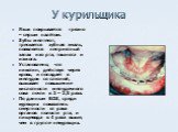У курильщика. Язык покрывается грязно – серым налётом. Зубы желтеют, трескается зубная эмаль, появляется неприятный запах изо рта, тошнота и изжога. Установлено, что никотин, действуя через кровь, и попадает в желудок со слюной, вызывает повышение кислотности желудочного сока почти в 2 – 2,5 раза. П