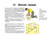 27. Массаж сердца. механическое воздействие на сердце после его остановки с целью восстановления деятельности и поддержания непрерывного кровотока до возобновления работы сердца. Показаниями к массажу сердца являются все случаи его остановки.    Признаки внезапной остановки сердца - резкая бледность