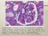  Микрофотография почечного тельца с юкстагломерулярным аппаратом, световой микроскоп, увеличение ×640. АА - афферентная артериола, DCT - дистальный извитой мочевой каналец, MD - плотное пятно почечного тельца нефрона, J - юкстагломерулярная клетка, L- экстрагломерулярная мезангиальная клетка (юкстав