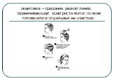 окантовка - придание резкой линии, ограничивающей край роста волос по всей голове или в отдельных ее участках.