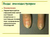 Онихолизис Характеризуется нарушением связи ногтевой пластинки с ногтевым ложем при сохранении целостности последней