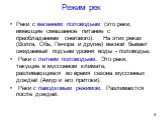 Режим рек. Реки с весенним половодьем (это реки, имеющие смешанное питание с преобладанием снегового). На этих реках (Волга, Обь, Печора и другие) весной бывает ожидаемый подъем уровня воды - половодье. Реки с летним половодьем. Это реки, текущие в муссонном климате, разливающиеся во время сезона му