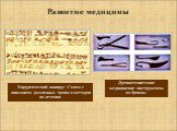 Древнеегипетские медицинские инструменты из бронзы. Развитие медицины. Хирургический папирус Смита с описанием различных травм и методов их лечения.