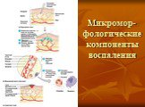 Микромор-фологические компоненты воспаления