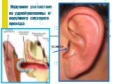 Наружное ухо состоит из ушной раковины и наружного слухового прохода. козелок