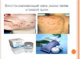 Восстанавливающий крем, маска против угревой сыпи. http://www.moi-roditeli.ru/pupil/bahaviour-development/skin-care-acne.html