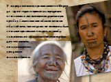 У народа апатани, проживающего в Индии, до 1970-х годов сохранялась традиция вставлять в нос женщинам деревянную пробку. Сами апатани объясняли этот обычай тем, что когда-то их женщины были самыми красивыми в округе, и, чтобы защитить их от похищений мужчинами других племён, лицо намеренно уродовали