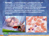 Малярия  — «плохой воздух», ранее известная как «болотная лихорадка») — группа инфекционных заболеваний, передаваемых человеку при укусах комаров «малярийных комаров») и сопровождающихся лихорадкой, ознобами, увеличением размеров селезёнки, увеличением размеров печени, анемией, Характеризуется хрони