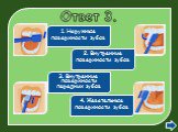 Ответ 3. 1. Наружные поверхности зубов. 2. Внутренние поверхности зубов. 3. Внутренние поверхности передних зубов. 4. Жевательные поверхности зубов