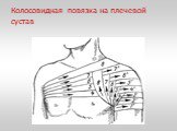 Колосовидная повязка на плечевой сустав