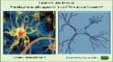 Нейроны головного мозга. Сравните два рисунка Что общего вы обнаружили в них? Чем они отличаются?
