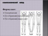 Соматоскопический метод: Форма ног: 1)нормалная 2)х-образная(вальвусная) 3)о-образная(варусная)
