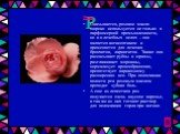 Р. Роза Оказывается, розовое масло широко используется не только в парфюмерной промышленности, но и в лечебных целях – оно является антисептиком и применяется для лечения бронхитов, ларингитов. Также оно рассасывает рубцы и шрамы, разглаживает морщины, нормализует кровообращение, препятствует варико