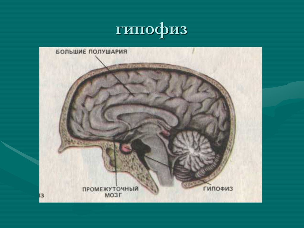Гипофиз функции мозг. Гипофиз промежуточный мозг. Гипофиз и большие полушария. Расположение гипофиза в головном мозге. Гипофиз средний мозг.