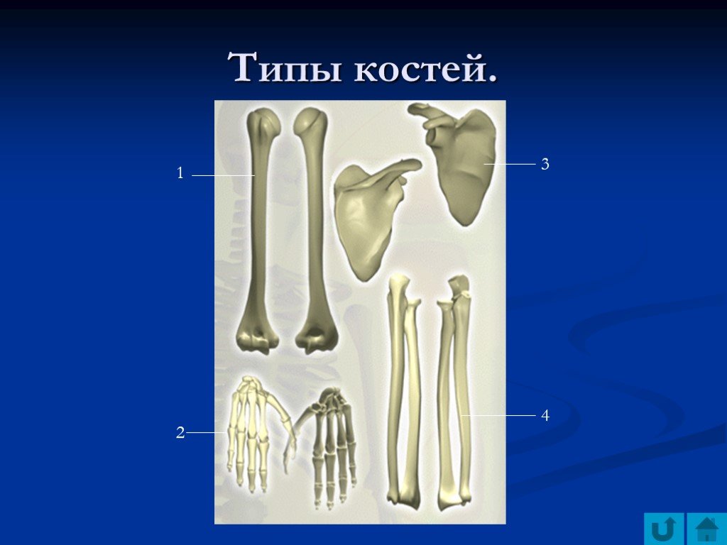 Поставить на 4 кости. Типы костей. 4 Типа кости. Типы костей в стоматологии. 3 Типа кости.