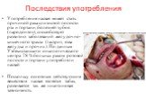 Последствия употребления. Употребление насвая может стать причиной рака слизистой полости рта и гортани, болезней зубов (пародонтоз), способствует развитию заболеваний желудочно-кишечного тракта (гастрит, язва желудка и прочих). По данным Узбекистанского онкологического центра 78 % больных раком рот
