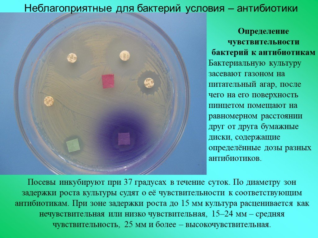 Экспериментатор решила установить какое количество бактерий. Питательная среда для бактерий. Неблагоприятные условия для бактерий. Условия роста бактерий. Посев бактерий на питательную среду.