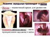 Развитие зародыша происходит в матке. Матка – мышечный орган для развития зародыша Плацента (детское место) – место прикрепления зародыша в матке