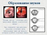 Образование звуков. Человек молчит – голосовая щель треугольной формы и достаточно велика. Звук появляется при неполном смыкании голосовой щели, прохождение через нее воздуха, который колеблет голосовые связки.