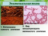 Эпителиальная ткань. 1. Фотоснимок кожного эпителия. 2. Вид микропрепарата железистого эпителия