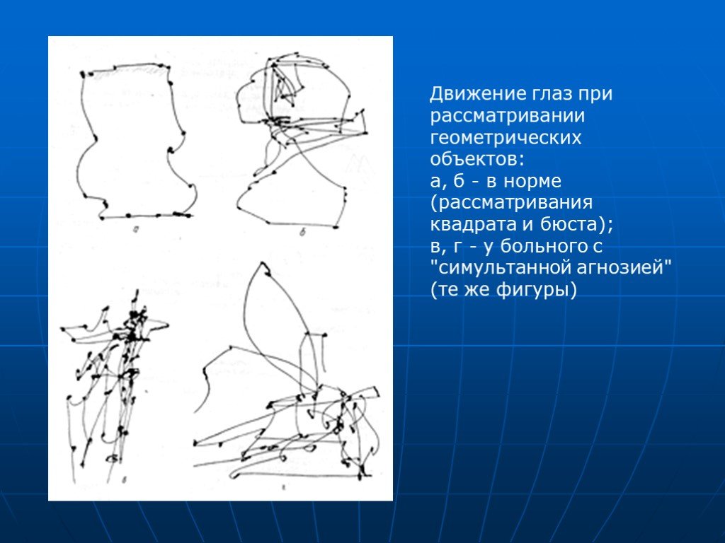 Движение глаз. Движение глаза при рассматривании. Движение глаз при рассматривании изображения. Траектория движения глаза при рассматривании картины. Окулограмма движения глаз.