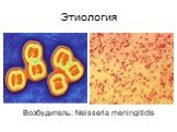Этиология. Возбудитель: Neisseria meningitidis