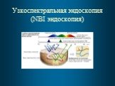 Узкоспектральная эндоскопия (NBI эндоскопия)