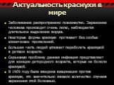 Актуальность краснухи в мире. Заболевание распространено повсеместно. Заражение человека происходит очень легко, наблюдается длительное выделение вируса. Некоторые формы краснухи протекают без особых клинических проявлений. Большая часть людей успевает переболеть краснухой в детском возрасте. Серьез