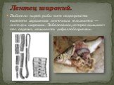 Любители сырой рыбы часто подвергаются опасности заражения ленточным гельминтом — лентецом широким. Заболевание, которое вызывает этот паразит, называется дифиллоботриозом. Лентец широкий.