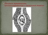 Личинка трихинеллы, инкапсулированная в мышечном волокне
