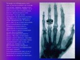 Вскоре он обнаружил, что икс-лучи вызывают не только свечение экрана, покрытого цианоплатинитом бария, но и потемнение фотопластинок (после проявления) в тех местах, где икс-лучи попадают на фотоэмульсию. Так Рёнтген стал первым в мире радиологом. В честь него икс-лучи стали называть рентгеновскими 