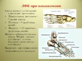 ЛФК при плоскостопии. Стопа состоит из 26 костей и включает три отдела: Предплюсна, заплюсна – 7 костей стопы. Плюсна – 5 трубчатых костей. Фаланги – 14 коротких трубчатых костей. Фаланги образуют пальцы стопы. Четыре пальца - из 3 фаланг, и лишь большой палец стопы - из 2 фаланг. Выделяют две повер