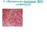 3. «Кровяные» (малярия, ВИЧ-инфекция);
