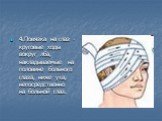 4.Повязка на глаз - круговые ходы вокруг лба, накладываемые на половине больного глаза, ниже уха, непосредственно на больной глаз.