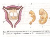 Строение матки: 1-матка, 2-зародыш, 3-плацента.