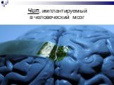 Чип, имплантируемый в человеческий мозг